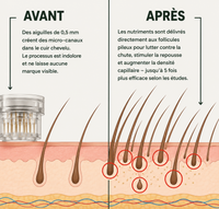 Sérum densifiant au Romarin par micro-infusion