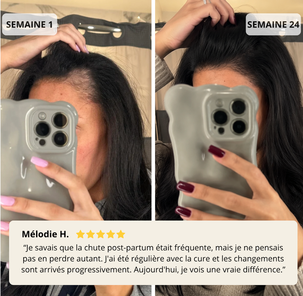Sérum densifiant au Romarin par micro-infusion