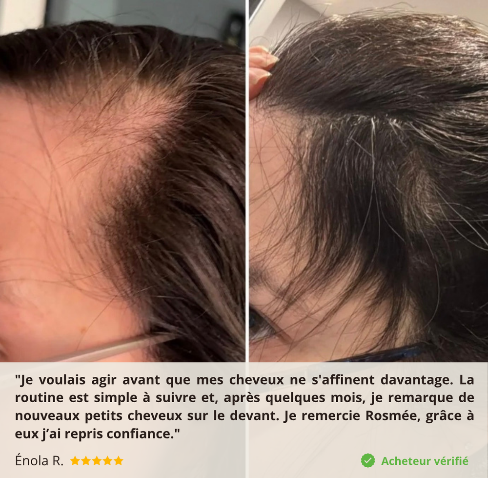 Sérum densifiant au Romarin par micro-infusion